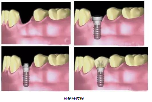 微信截图_20170220102113.png