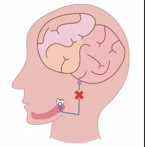 智齿科普示意图 918博天堂阳光口腔