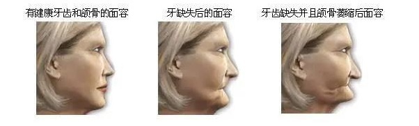 导致面容显得衰老